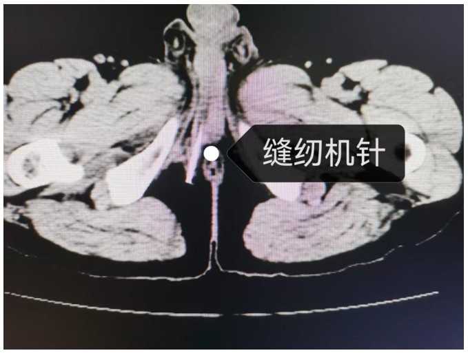 Snipaste_2025-02-11_11-49-01.jpg Snipaste_2025-02-11_11-49-01.jpg